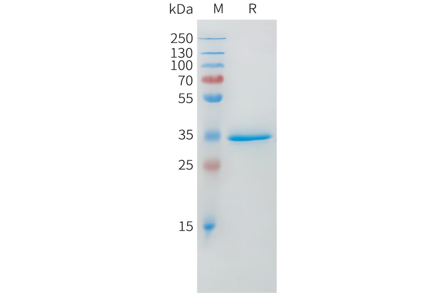 SDS-PAGE - Recombinant Human DLL3 Protein (Fc Tag) (A324970) - Antibodies.com