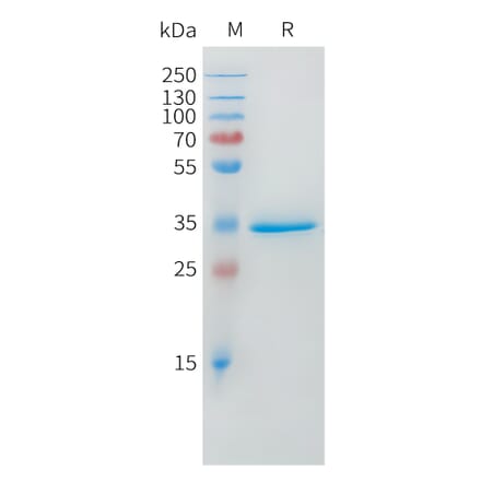 SDS-PAGE - Recombinant Human DLL3 Protein (Fc Tag) (A324970) - Antibodies.com