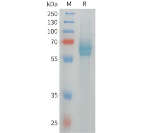 SDS-PAGE - Recombinant Human DLL4 Protein (6xHis Tag) (A324971) - Antibodies.com