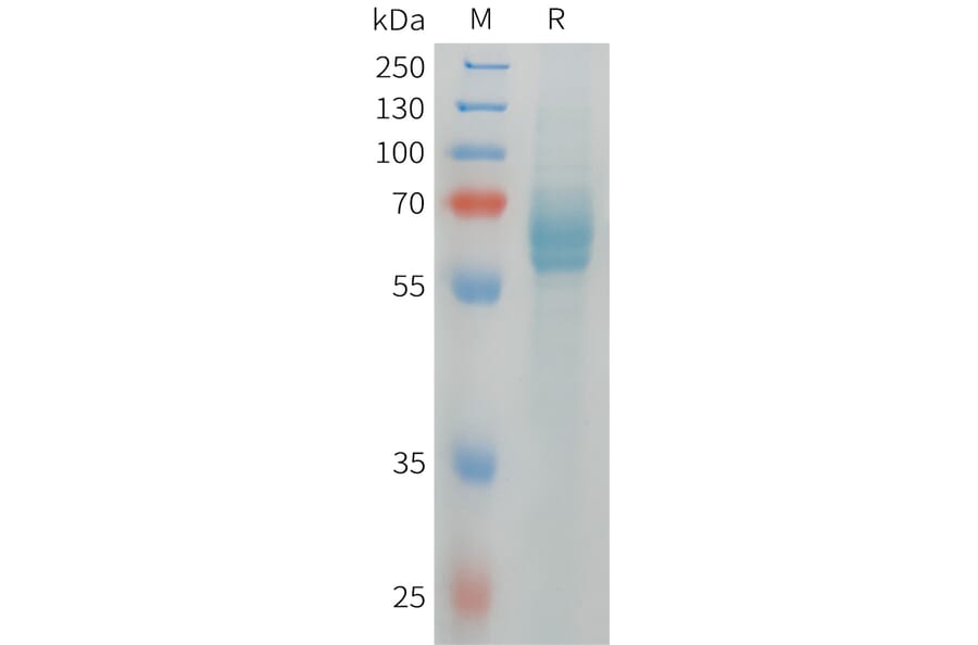 SDS-PAGE - Recombinant Human DLL4 Protein (6xHis Tag) (A324971) - Antibodies.com