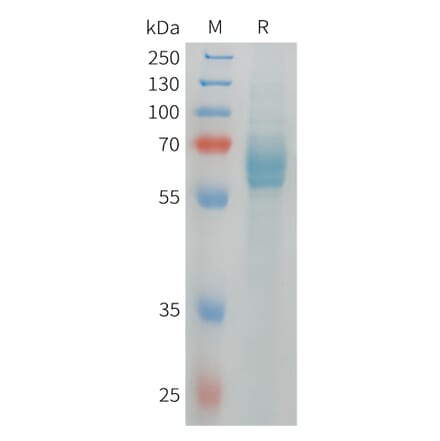SDS-PAGE - Recombinant Human DLL4 Protein (6xHis Tag) (A324971) - Antibodies.com