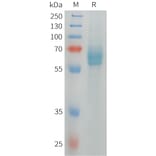 SDS-PAGE - Recombinant Human DLL4 Protein (6xHis Tag) (A324971) - Antibodies.com