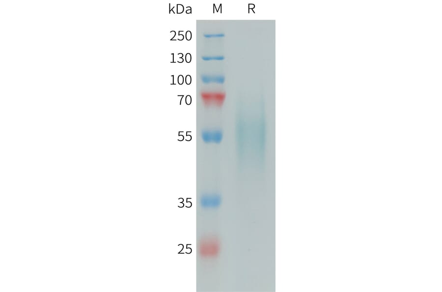 SDS-PAGE - Recombinant Human DR6 Protein (6xHis Tag) (A324972) - Antibodies.com