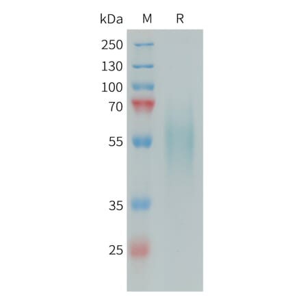 SDS-PAGE - Recombinant Human DR6 Protein (6xHis Tag) (A324972) - Antibodies.com