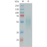SDS-PAGE - Recombinant Human DR6 Protein (6xHis Tag) (A324972) - Antibodies.com