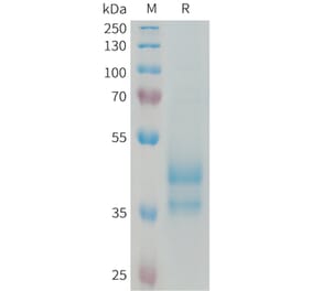 SDS-PAGE - Recombinant Human Eotaxin 2 Protein (Fc Tag) (A324973) - Antibodies.com