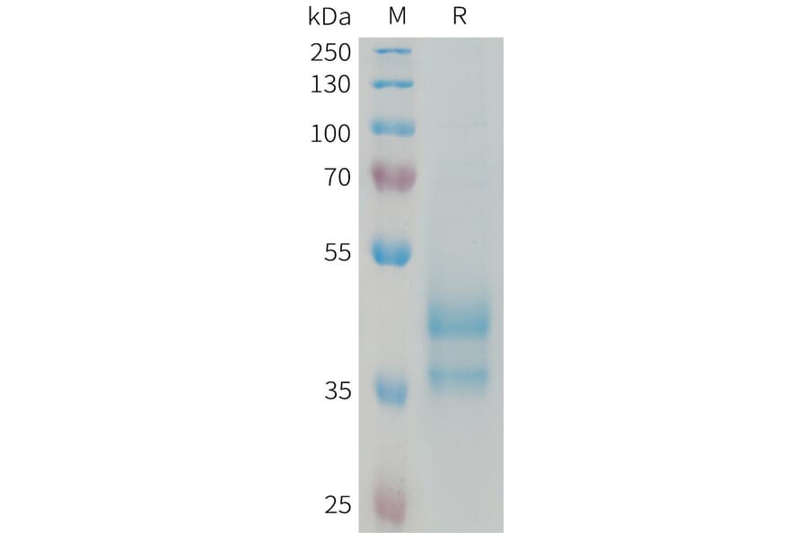 SDS-PAGE - Recombinant Human Eotaxin 2 Protein (Fc Tag) (A324973) - Antibodies.com