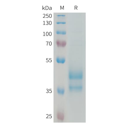 SDS-PAGE - Recombinant Human Eotaxin 2 Protein (Fc Tag) (A324973) - Antibodies.com