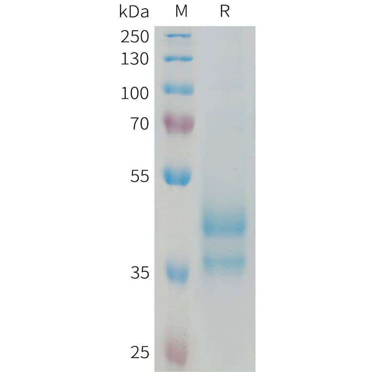 SDS-PAGE - Recombinant Human Eotaxin 2 Protein (Fc Tag) (A324973) - Antibodies.com