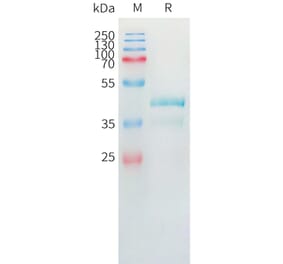 SDS-PAGE - Recombinant Human Eotaxin 2 Protein (Fc Tag) (A324974) - Antibodies.com