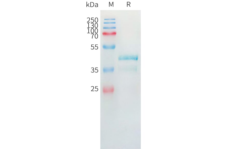 SDS-PAGE - Recombinant Human Eotaxin 2 Protein (Fc Tag) (A324974) - Antibodies.com