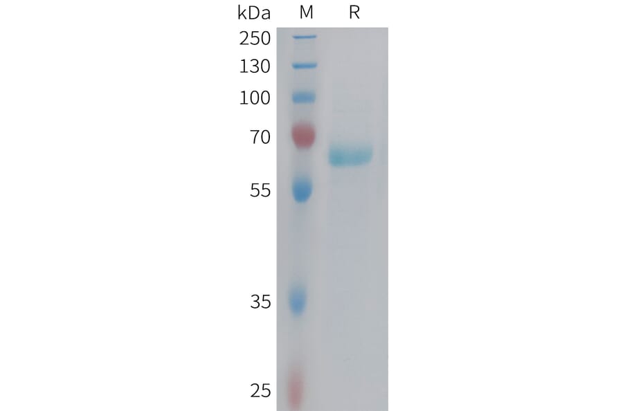 SDS-PAGE - Recombinant Human Eph Receptor B3 Protein (6xHis Tag) (A324975) - Antibodies.com