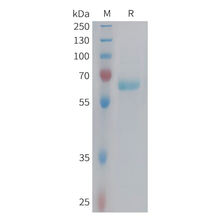 SDS-PAGE - Recombinant Human Eph Receptor B3 Protein (6xHis Tag) (A324975) - Antibodies.com