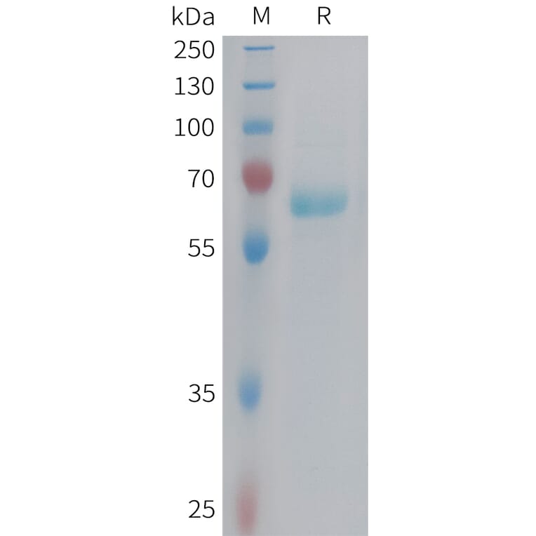 SDS-PAGE - Recombinant Human Eph Receptor B3 Protein (6xHis Tag) (A324975) - Antibodies.com