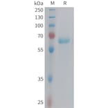 SDS-PAGE - Recombinant Human Eph Receptor B3 Protein (6xHis Tag) (A324975) - Antibodies.com