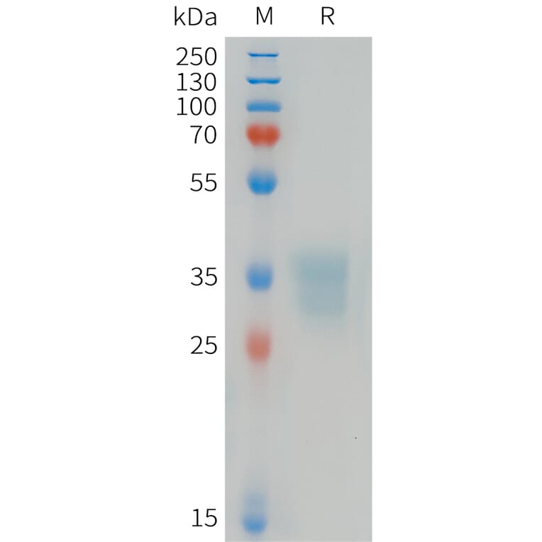 SDS-PAGE - Recombinant Human Ephrin B1 Protein (6xHis Tag) (A324976) - Antibodies.com