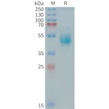SDS-PAGE - Recombinant Human ErbB3/HER3 Protein (Fc Tag) (A324977) - Antibodies.com