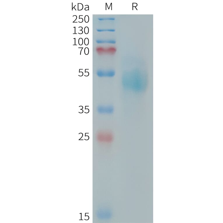 SDS-PAGE - Recombinant Human ErbB3/HER3 Protein (Fc Tag) (A324978) - Antibodies.com