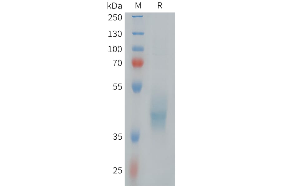 SDS-PAGE - Recombinant Human ErbB3/HER3 Protein (Fc Tag) (A324979) - Antibodies.com