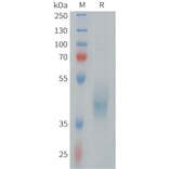 SDS-PAGE - Recombinant Human ErbB3/HER3 Protein (Fc Tag) (A324979) - Antibodies.com