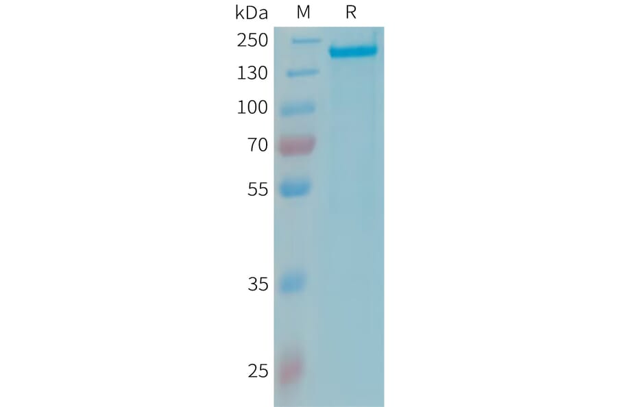 SDS-PAGE - Recombinant Human Factor H Protein (10xHis Tag) (A324981) - Antibodies.com