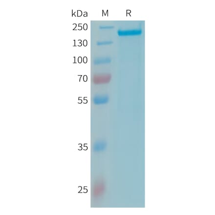 SDS-PAGE - Recombinant Human Factor H Protein (10xHis Tag) (A324981) - Antibodies.com