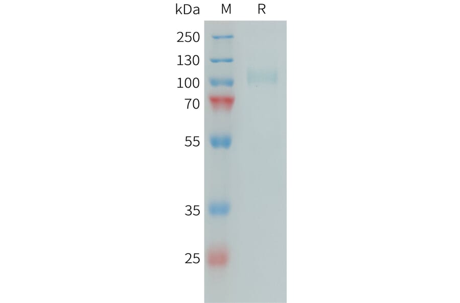 SDS-PAGE - Recombinant Human Factor I/CFI Protein (6xHis Tag) (A324982) - Antibodies.com