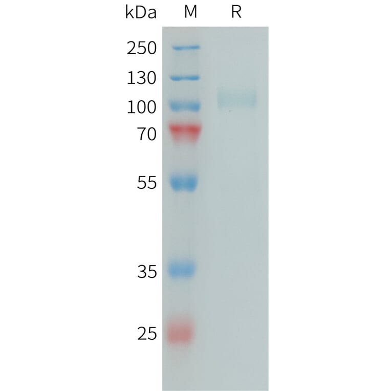 SDS-PAGE - Recombinant Human Factor I/CFI Protein (6xHis Tag) (A324982) - Antibodies.com