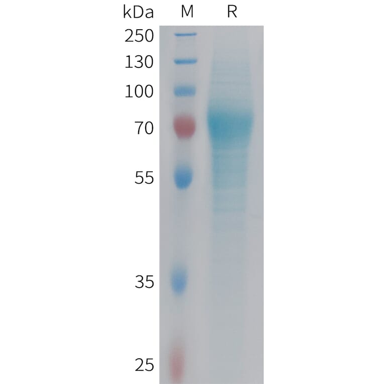 SDS-PAGE - Recombinant Human Factor IX/PTC Protein (6xHis Tag) (A324983) - Antibodies.com