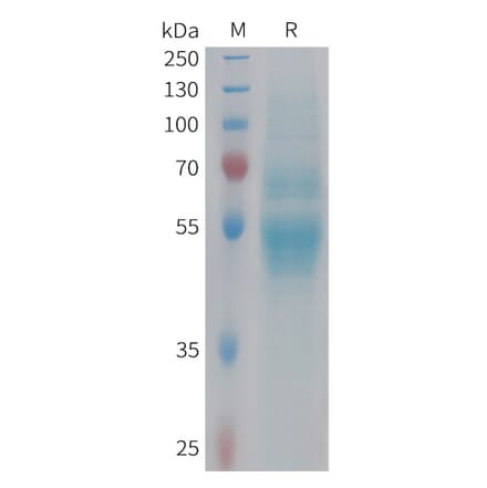 SDS-PAGE - Recombinant Human Factor X Protein (6xHis Tag) (A324984) - Antibodies.com