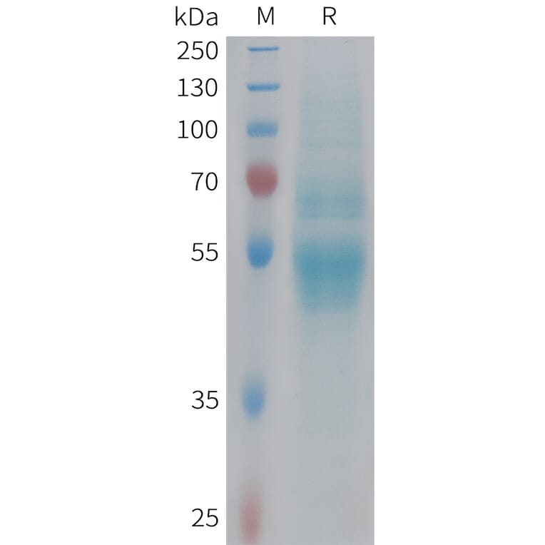 SDS-PAGE - Recombinant Human Factor X Protein (6xHis Tag) (A324984) - Antibodies.com
