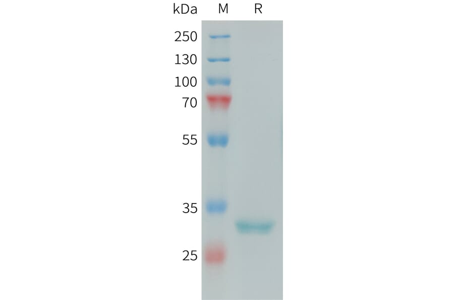 SDS-PAGE - Recombinant Human FCN1/M-Ficolin Protein (6xHis Tag) (A324986) - Antibodies.com