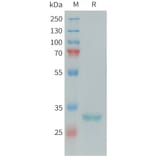SDS-PAGE - Recombinant Human FCN1/M-Ficolin Protein (6xHis Tag) (A324986) - Antibodies.com