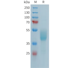 SDS-PAGE - Recombinant Human FCRL5 Protein (Fc Tag) (A324987) - Antibodies.com