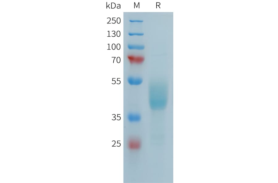 SDS-PAGE - Recombinant Human FCRL5 Protein (Fc Tag) (A324987) - Antibodies.com