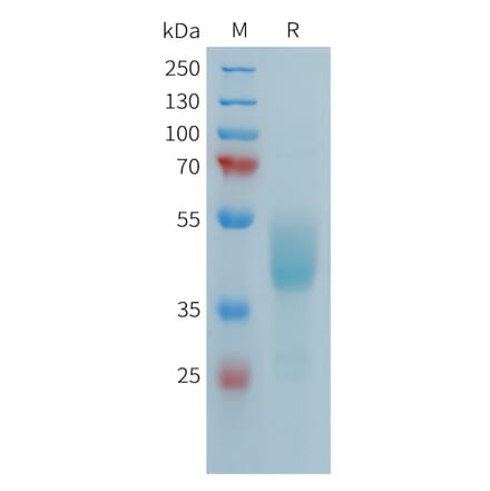 SDS-PAGE - Recombinant Human FCRL5 Protein (Fc Tag) (A324987) - Antibodies.com