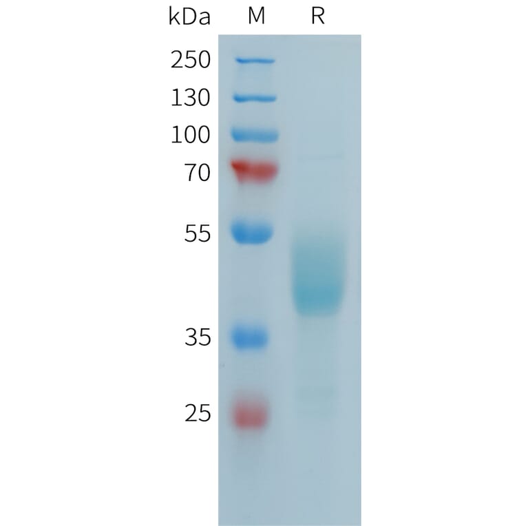 SDS-PAGE - Recombinant Human FCRL5 Protein (Fc Tag) (A324987) - Antibodies.com
