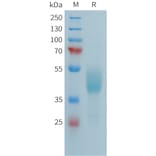SDS-PAGE - Recombinant Human FCRL5 Protein (Fc Tag) (A324987) - Antibodies.com