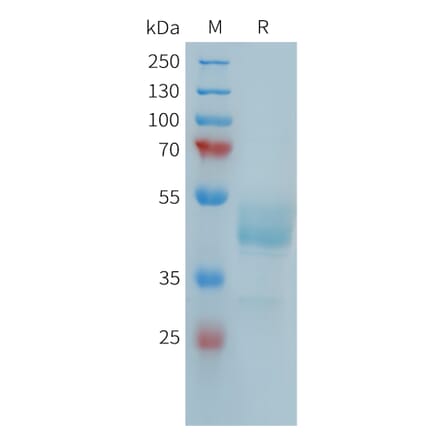 SDS-PAGE - Recombinant Human FCRL5 Protein (Fc Tag) (A324988) - Antibodies.com