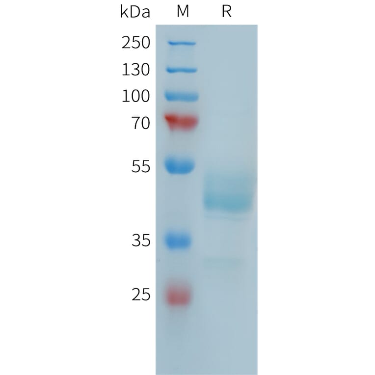 SDS-PAGE - Recombinant Human FCRL5 Protein (Fc Tag) (A324988) - Antibodies.com