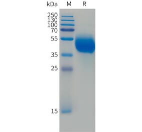 SDS-PAGE - Recombinant Human FCRL5 Protein (Fc Tag) (A324989) - Antibodies.com