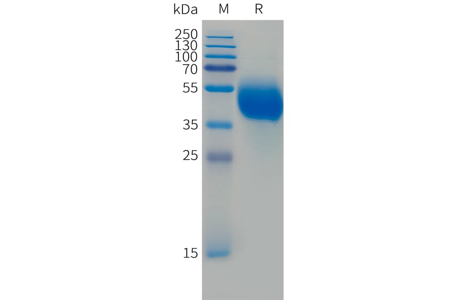 SDS-PAGE - Recombinant Human FCRL5 Protein (Fc Tag) (A324989) - Antibodies.com