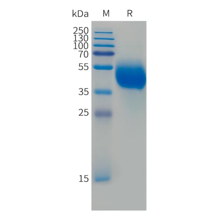 SDS-PAGE - Recombinant Human FCRL5 Protein (Fc Tag) (A324989) - Antibodies.com
