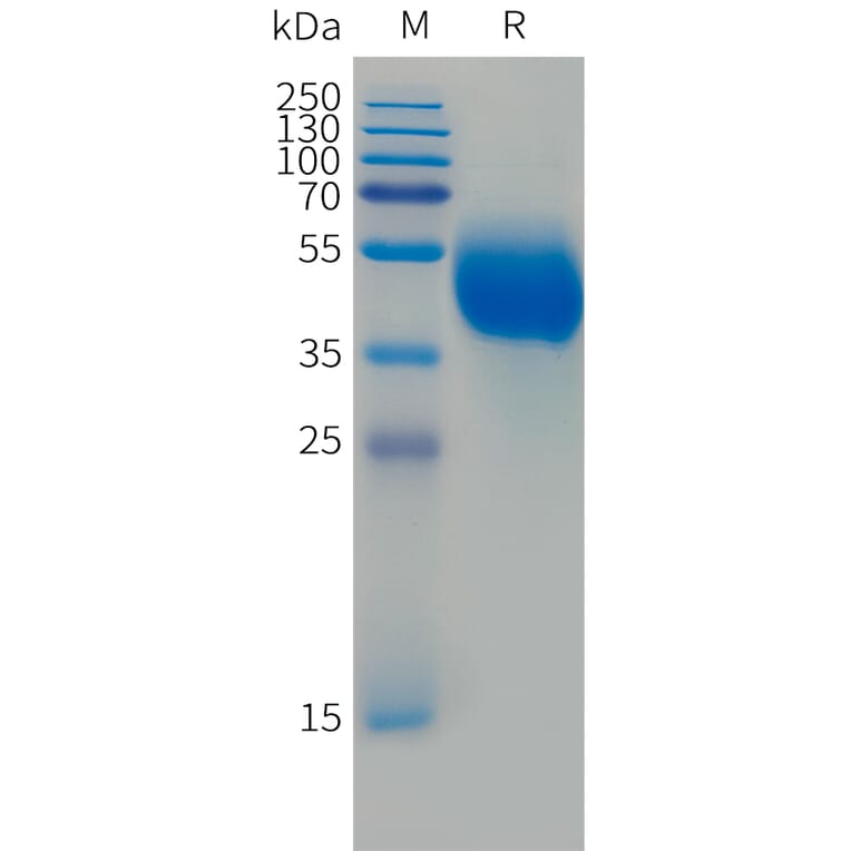 SDS-PAGE - Recombinant Human FCRL5 Protein (Fc Tag) (A324989) - Antibodies.com
