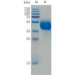SDS-PAGE - Recombinant Human FCRL5 Protein (Fc Tag) (A324989) - Antibodies.com