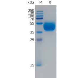 SDS-PAGE - Recombinant Human FCRL5 Protein (Fc Tag) (A324990) - Antibodies.com