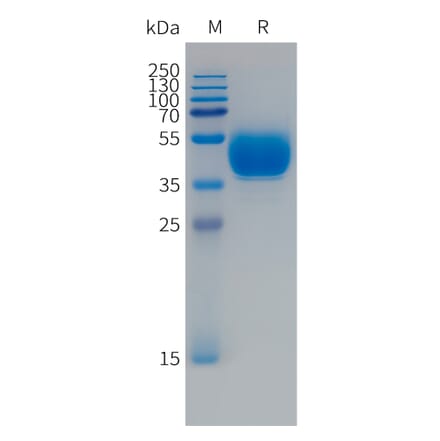 SDS-PAGE - Recombinant Human FCRL5 Protein (Fc Tag) (A324990) - Antibodies.com