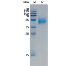 SDS-PAGE - Recombinant Human FCRL5 Protein (Fc Tag) (A324991) - Antibodies.com