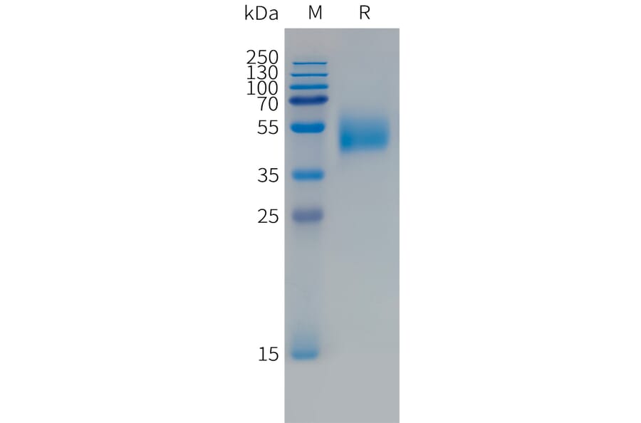 SDS-PAGE - Recombinant Human FCRL5 Protein (Fc Tag) (A324991) - Antibodies.com