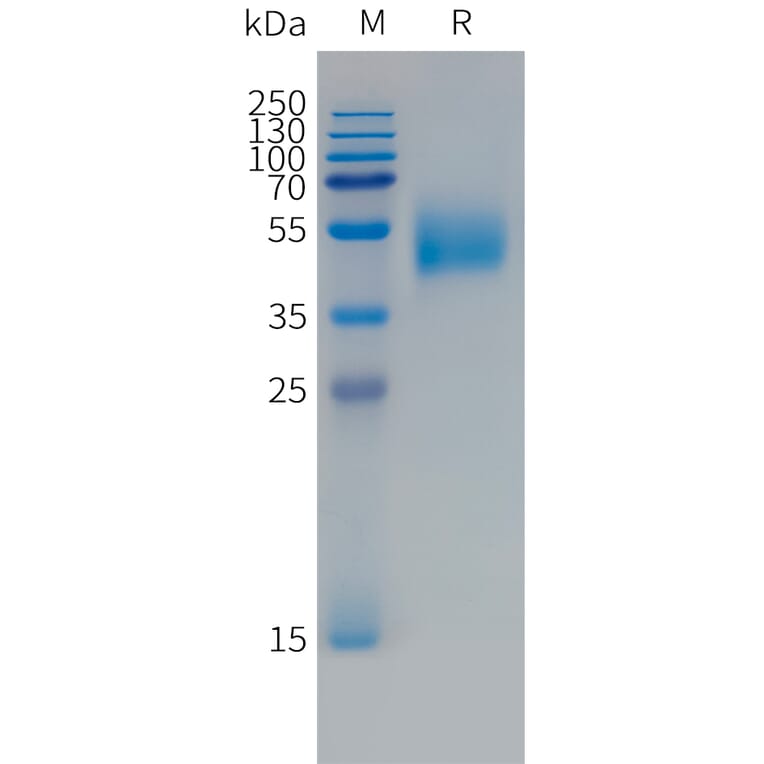 SDS-PAGE - Recombinant Human FCRL5 Protein (Fc Tag) (A324991) - Antibodies.com